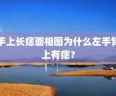 手上长痣面相图为什么左手臂上有痣？